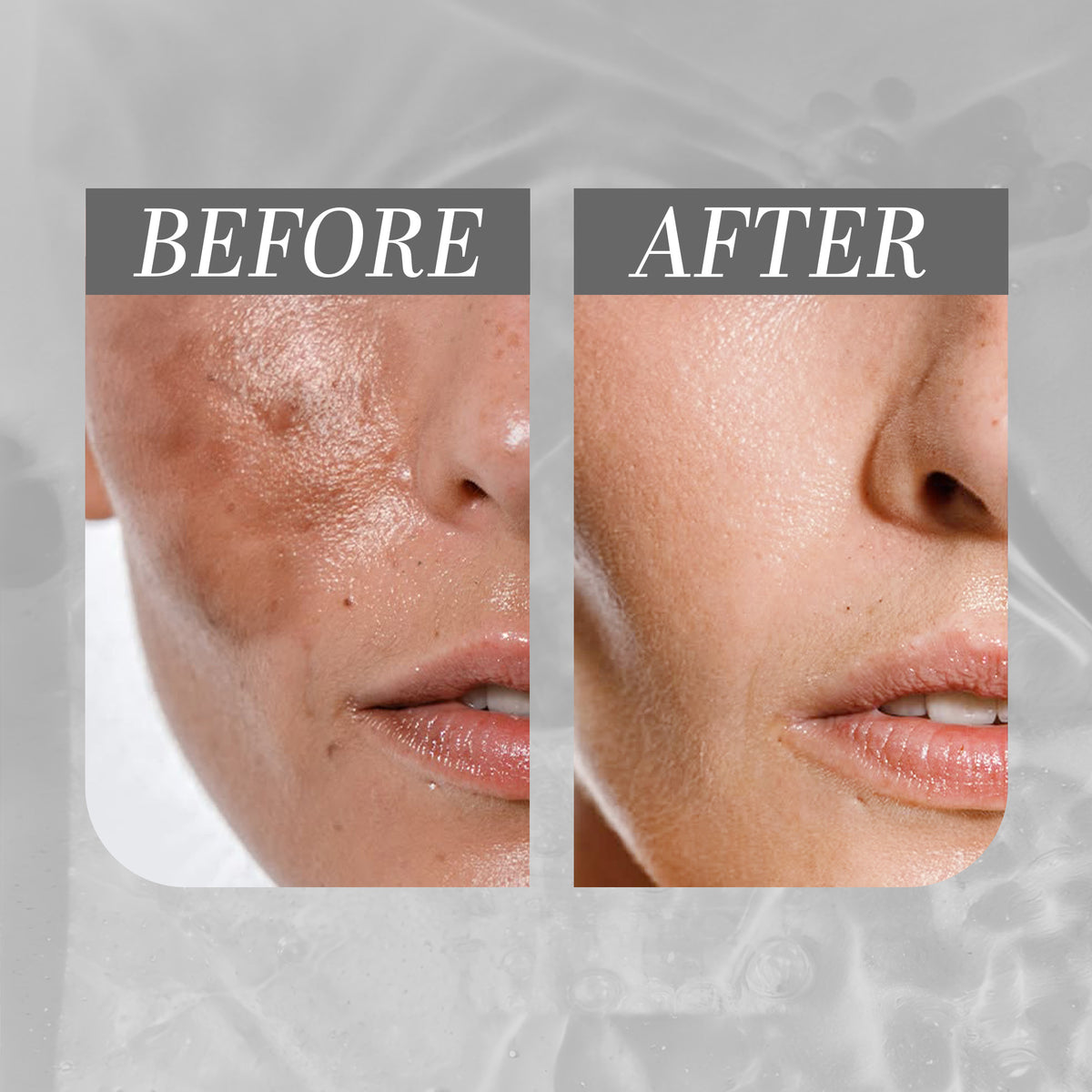 Miss Je Lu All In One Dark Spots Correcting Cream 60 gm with (Thiamidol-TXA-Arbutin)