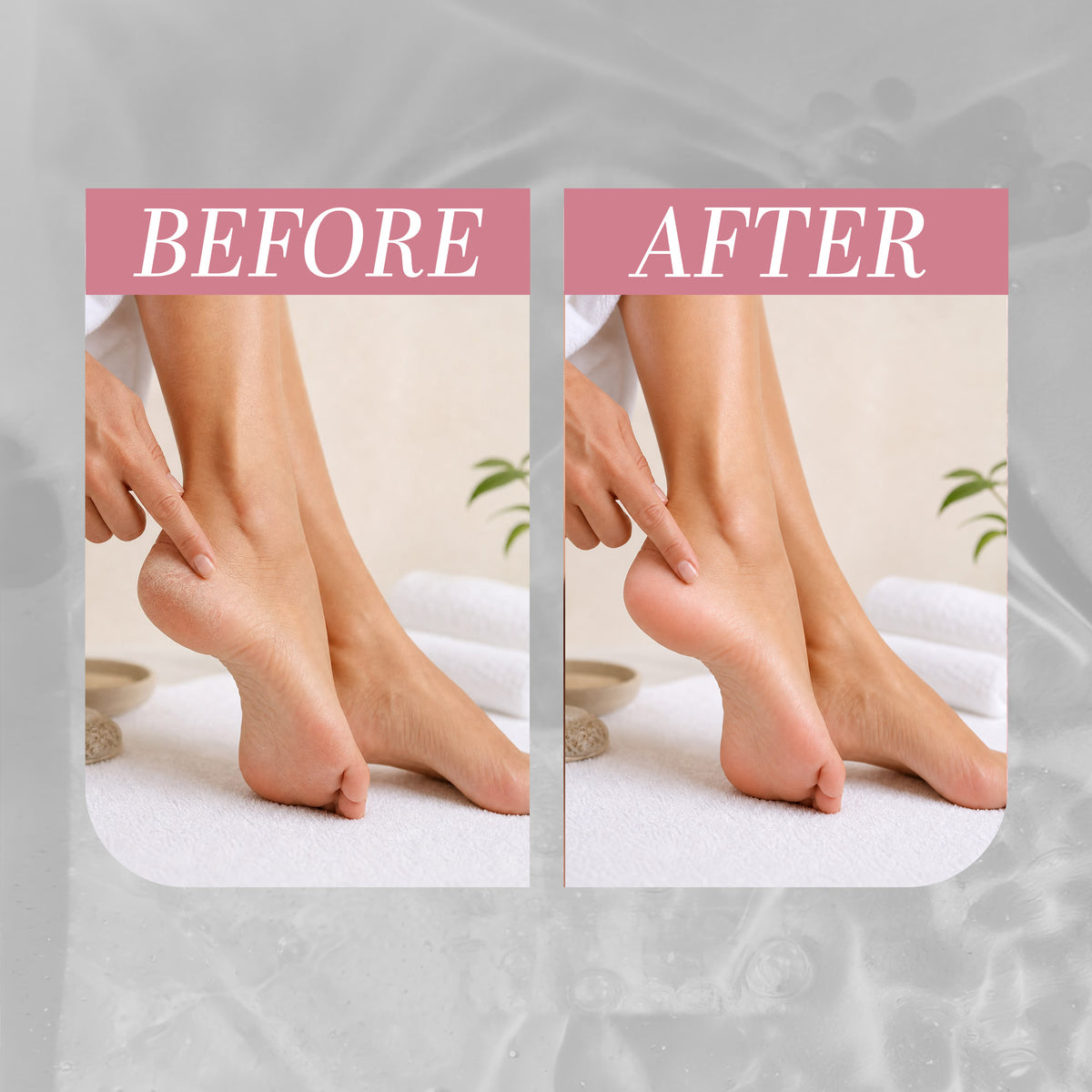 Miss Je Lu Moisturizing & Softening Foot Cream Urea 10%  (60gm)