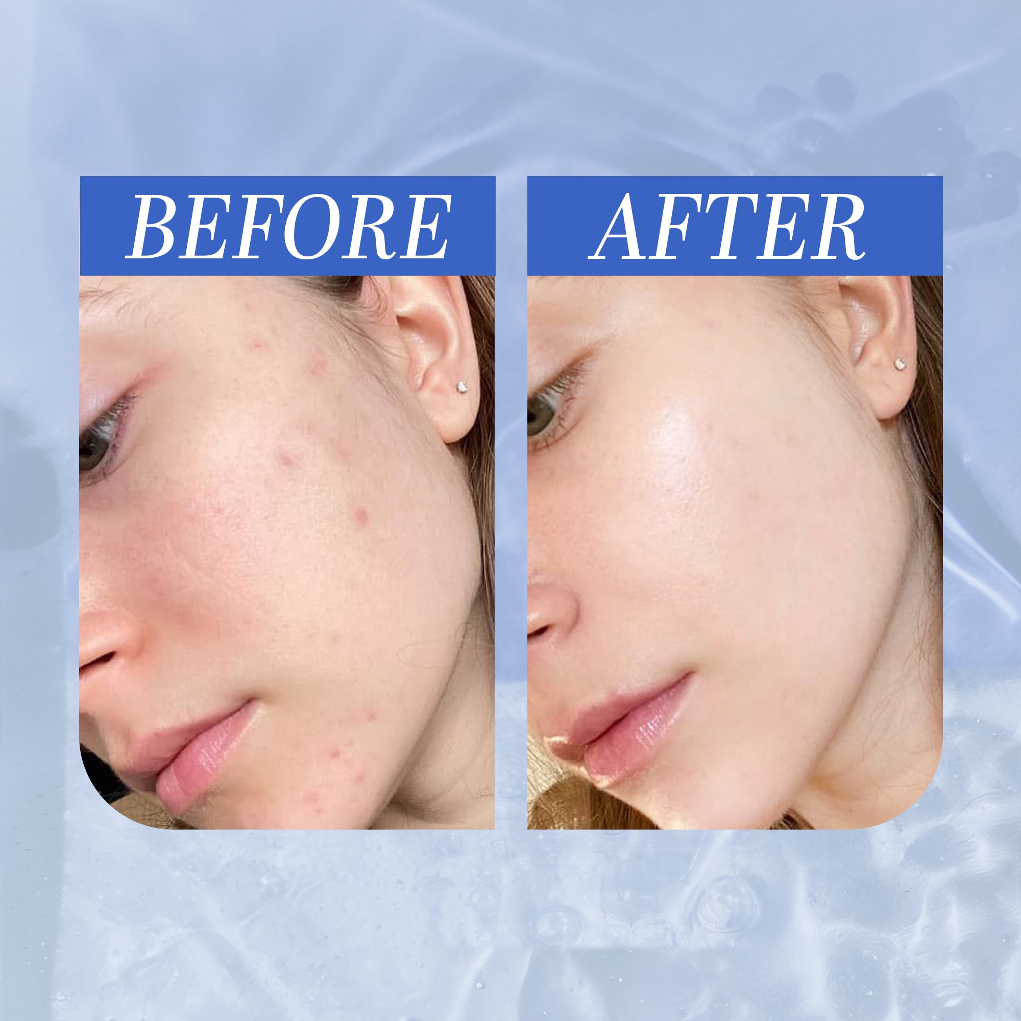 MJ　Ibiza+ Professional Serum 30ml Miss Je Lu Hyaluronic Deep Hydrating Serum30 ml – Miss.je.lu